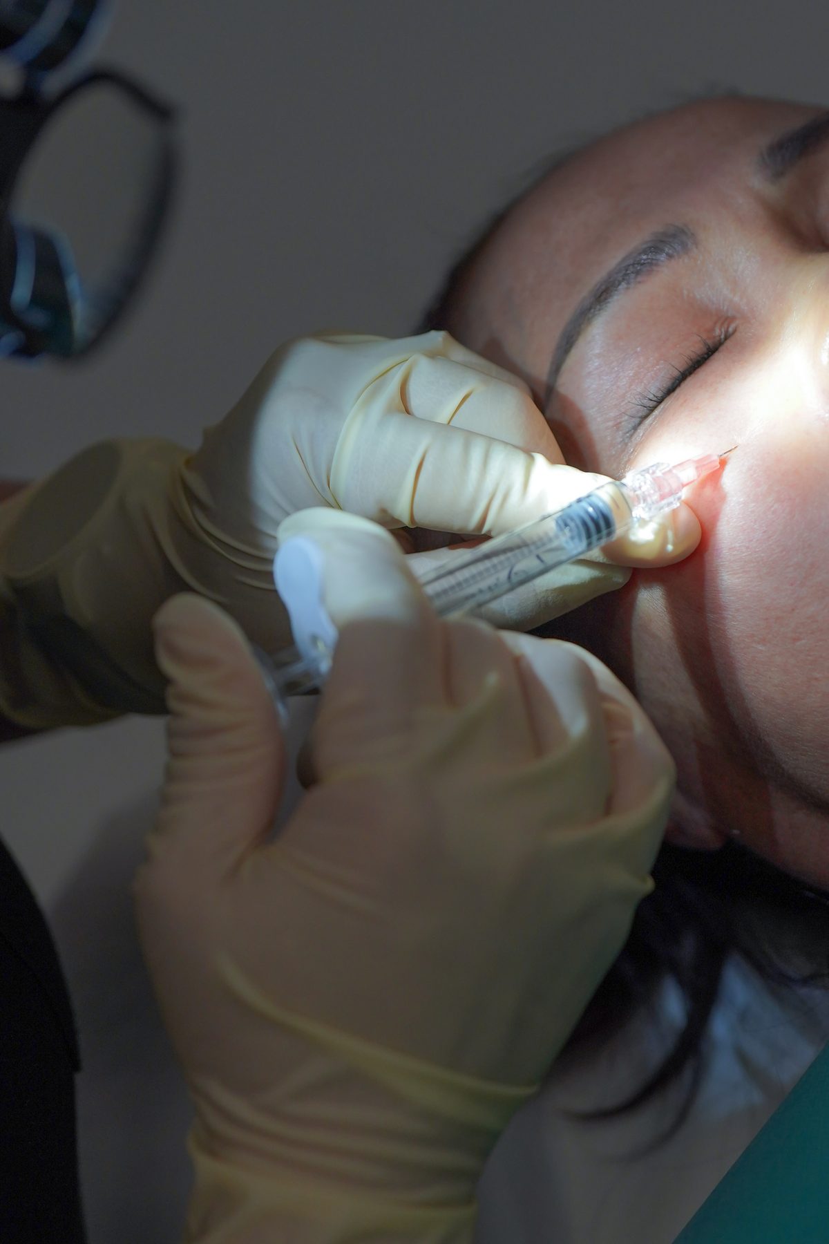 Beauty Pheresis™ — Gallery — 15